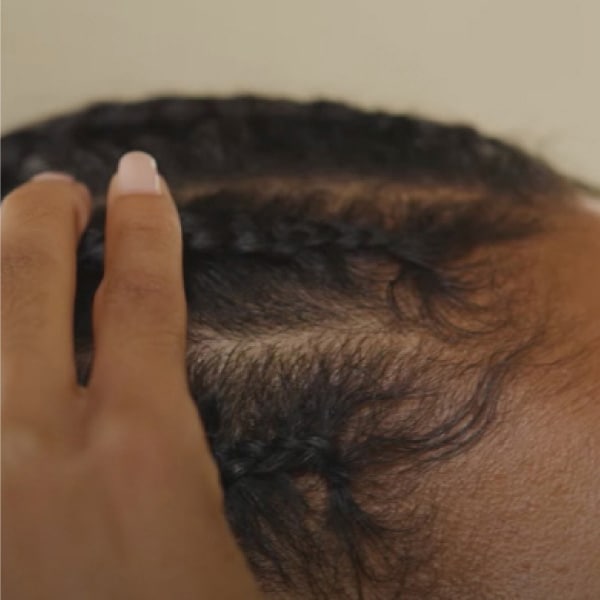 Scalp care for protective styles