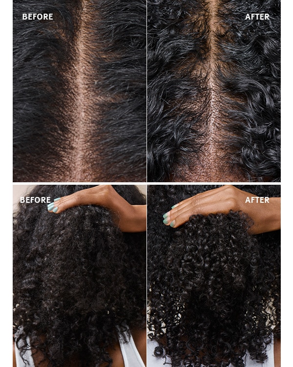 See the difference when using scalp solutions