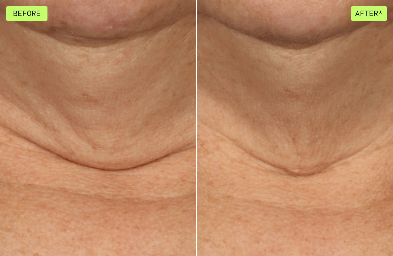 See the difference when using botanical repair